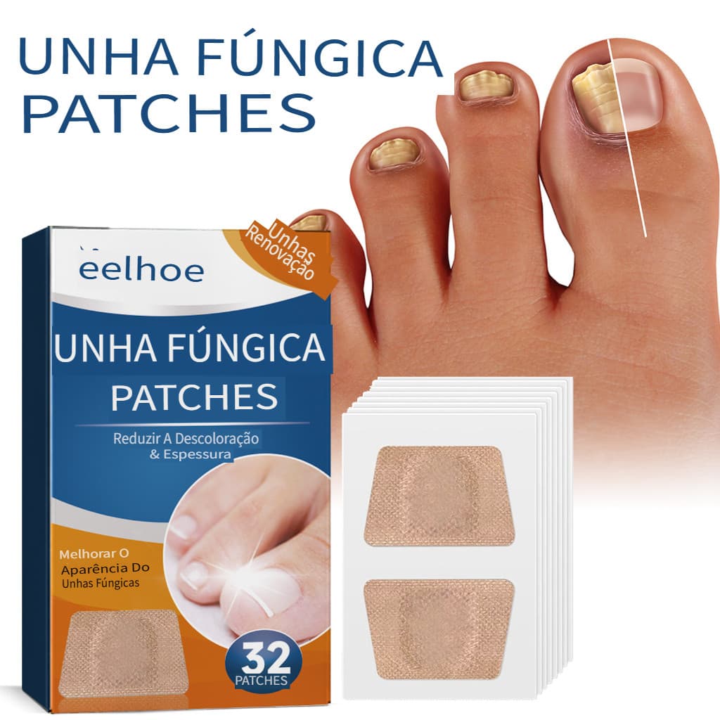 [Entrega 24 horas]50 Peças Adesivos para Cuidados com Unhas - Auxiliar no Tratamento de Onicomicose