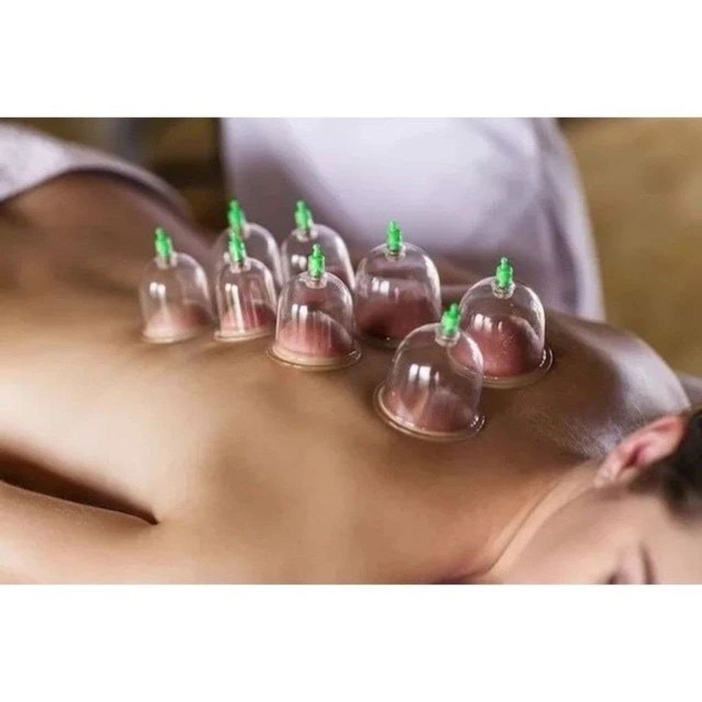 Conjunto de ventosas corporais