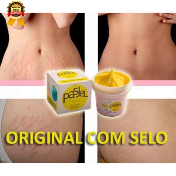 (Estoque Pronto) Remoção De Estrias Em Creme E Cicatriz Pós-Parto Com Selo De Garantia