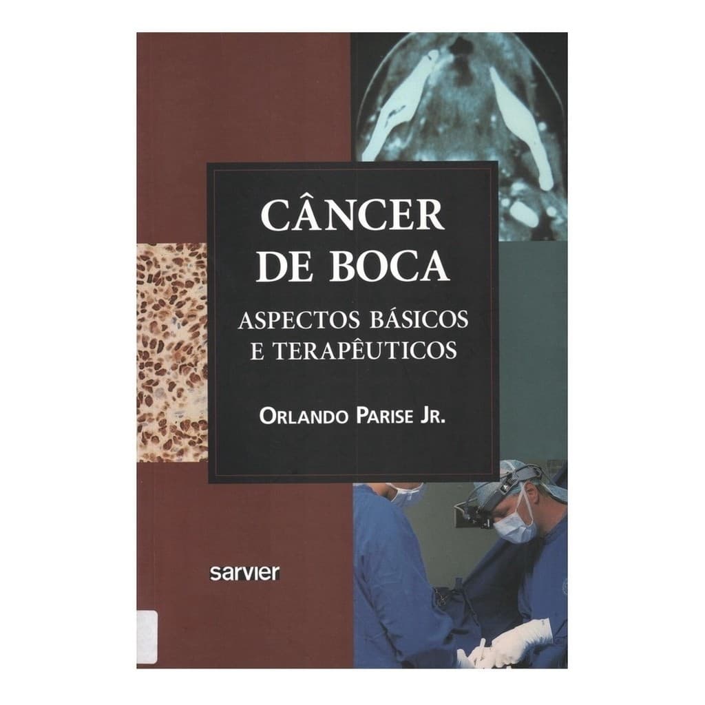 Livro - Cancêr De Boca - Aspectos Básicos E Terapêuticos