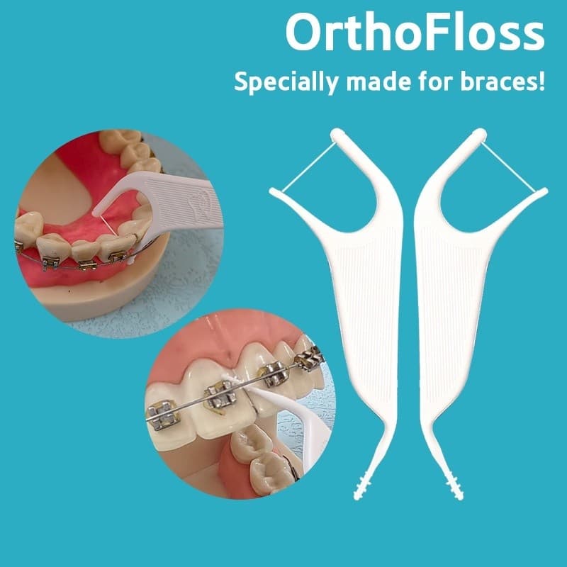 Fio Ortodôntico 50 Unidades/Saco Para Pacientes Com Aparelho Dentário