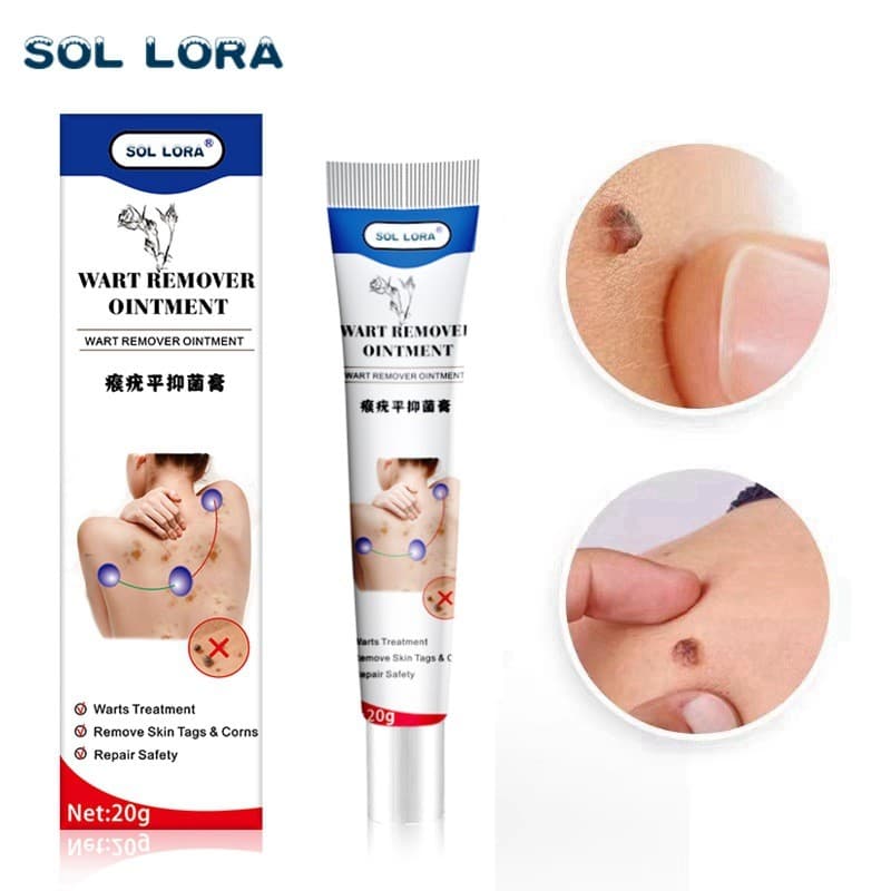 Qu Yu Gao Huang Ping Pomada Para Verrugas De Seda Manchas De Olhos De Frango