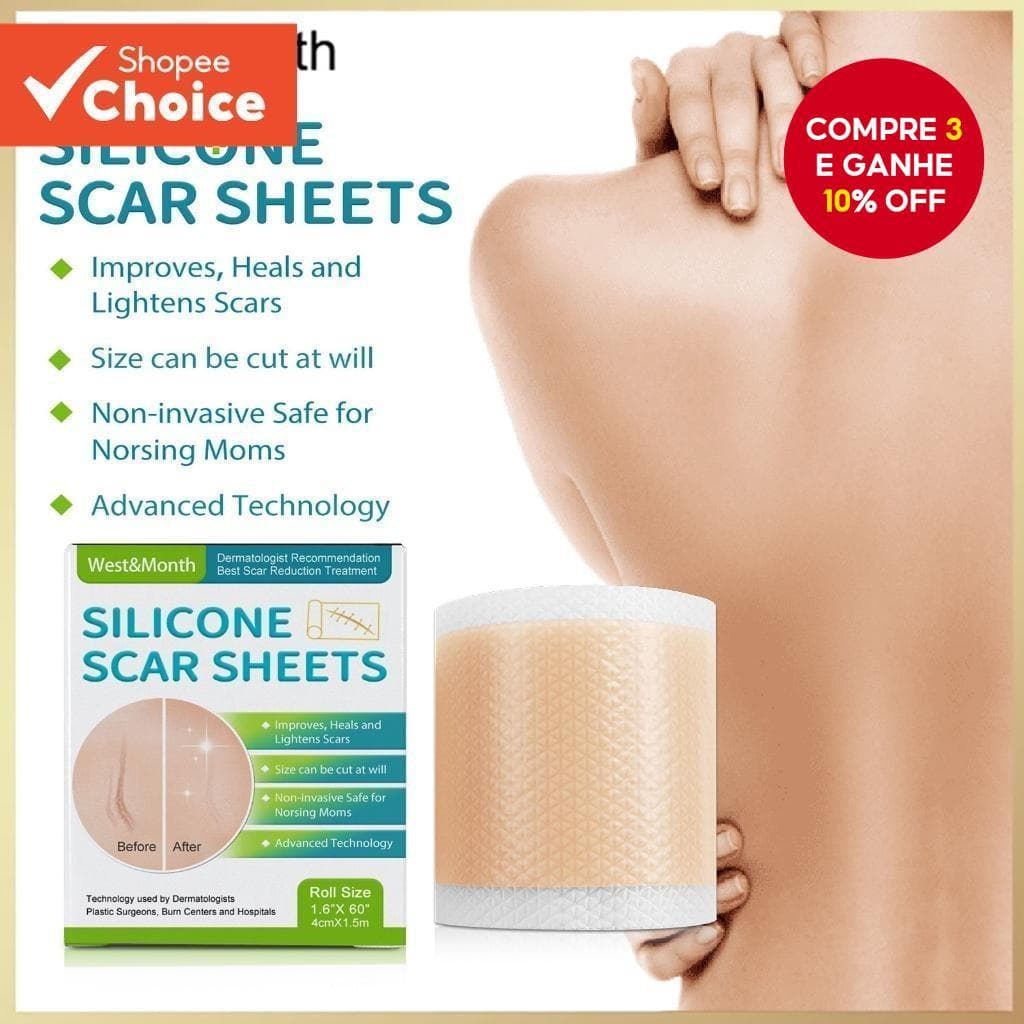 1 Pçs 4 * 1.5m Oeste & Mês Silicone Cicatriz Remendo Remover Acne Queimar Tratamento Capa Fita Rolo À Prova Dwaterproof 