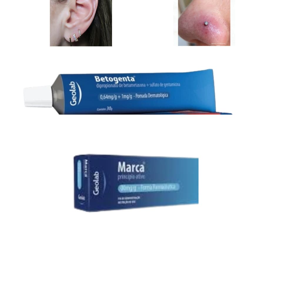 Betogen Pomada para Queloid de Piercing 30g