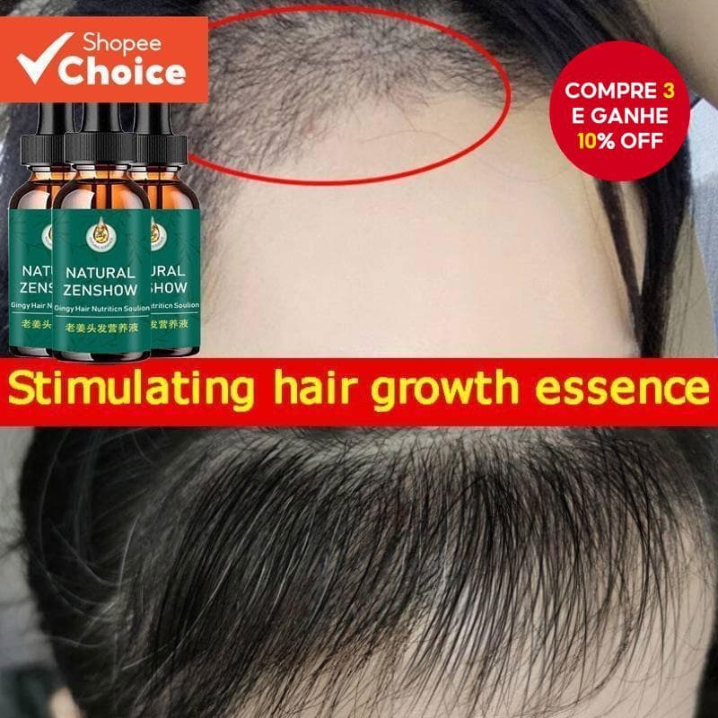 África Óleo Essencial K3X4 Para Crescimento de Cabelos Capilar Tração Louco Gengibre Selvagem Prevenir Alopecia