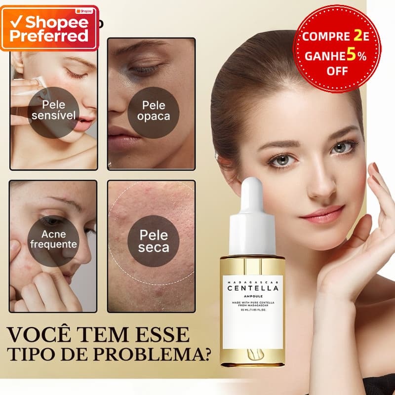 Centella Asiatica Essência Facial Reduz Melanina Iluminando Hidratante Suavizante Essência Facial