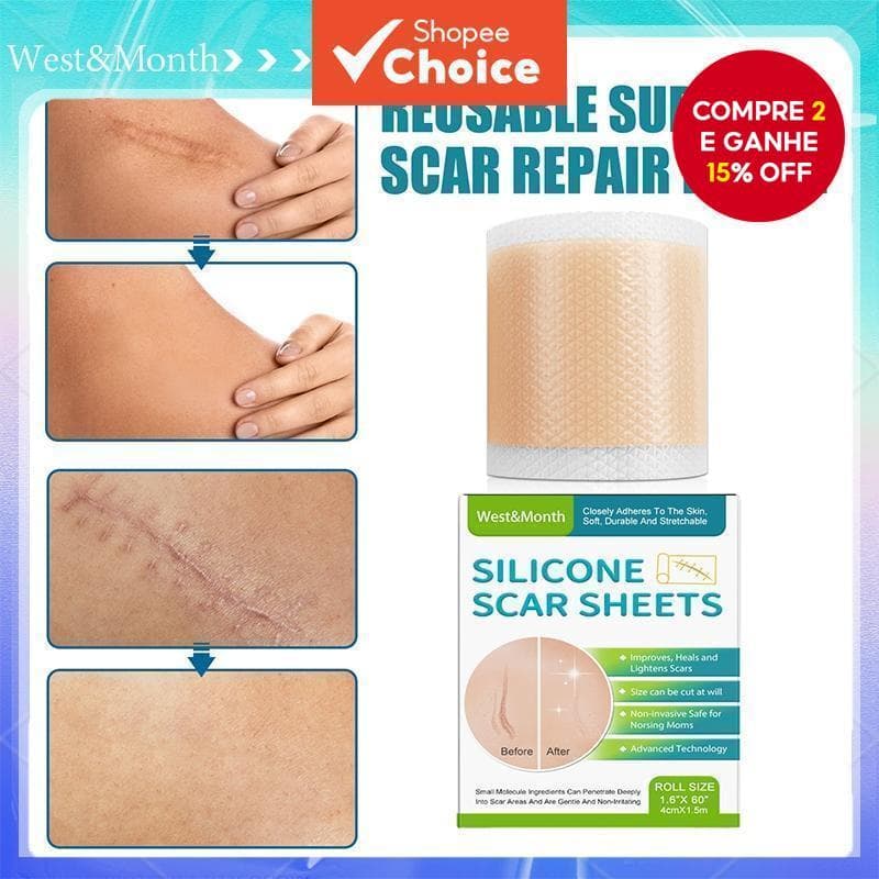 Adesivo De Cicatriz De Silicone West & Mês 4 * 150 Cm Desbota Todos Os Tipos De Cicatrizes Beleza Suave Para Cuidados Co