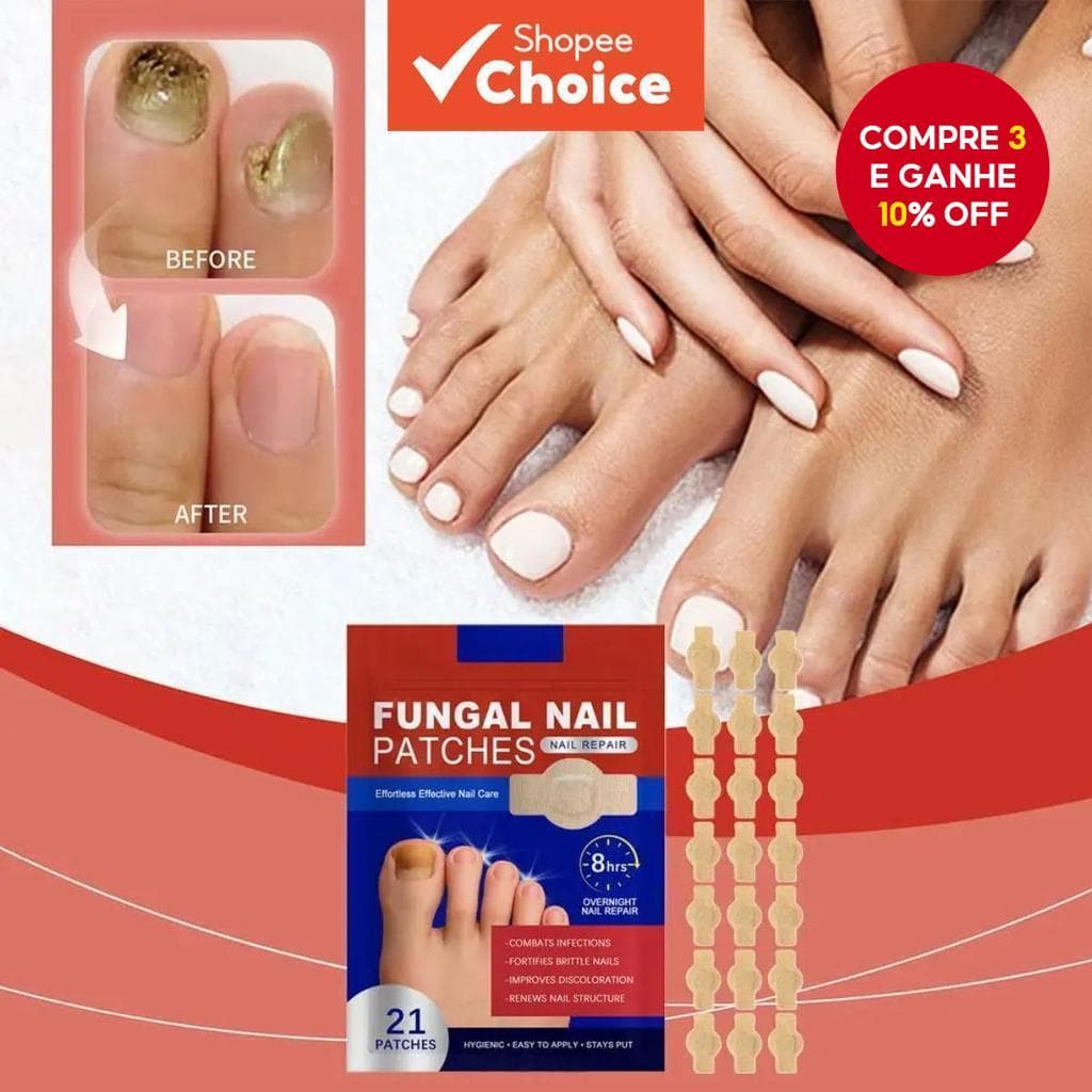  NOVO 21Pçs Adesivo para Fungo de Unha Impermeável Reparador de Unha Adesivo de Correção para Unha Encravada Unha