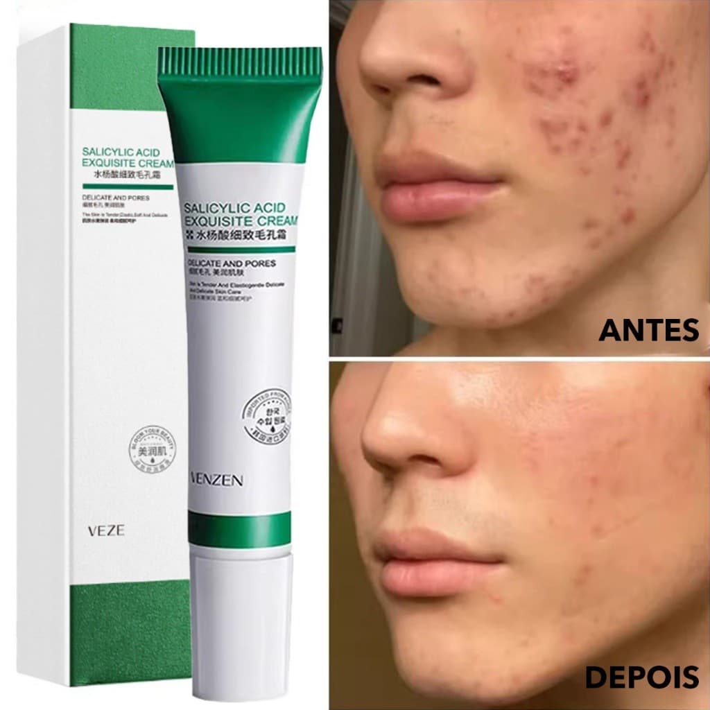 Creme de Ácido Salicílico para Redução de Poros - Loção Facial Hidratante Redução de Poros Dilatados