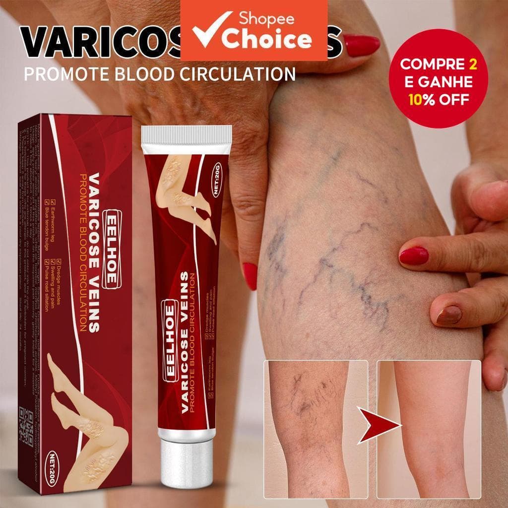 20g De Creme Calmante Para Veias Varicosas | Extrato De Gerânio , Trevo E Erva-Mãe Fortalece As , Textura Leve