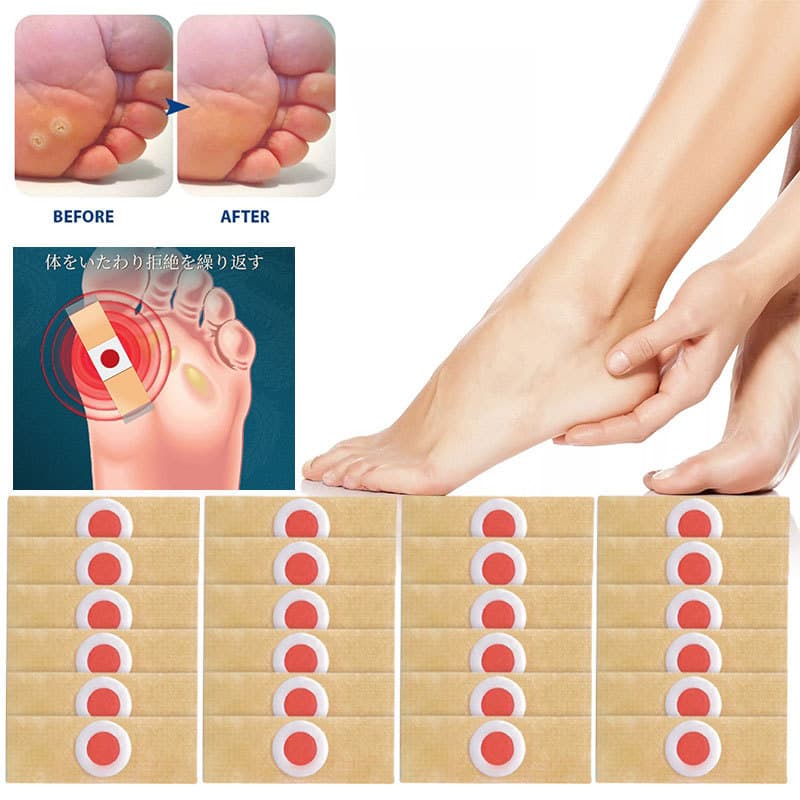 Adesivos Removedores De Calos De Pés De Olho De Peixe , Tratamento Diário Para Conforto E Cuidados