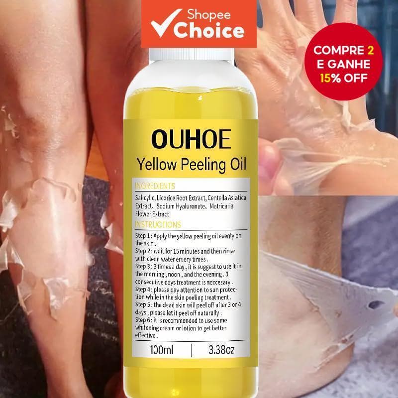 Óleo De Peeling Amarelo 100ml Para Pele Escura , Forte , Solução Esfoliante ,