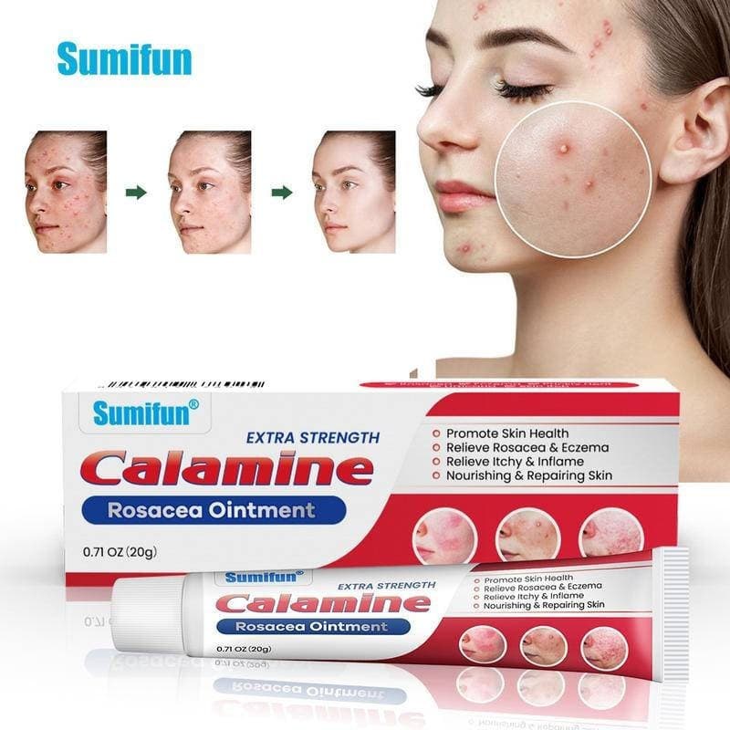 20g Pomada de Calamina Rosácea Extra Forte Reparação de Acne Creme Calmante Tratamento de Pele 70EH