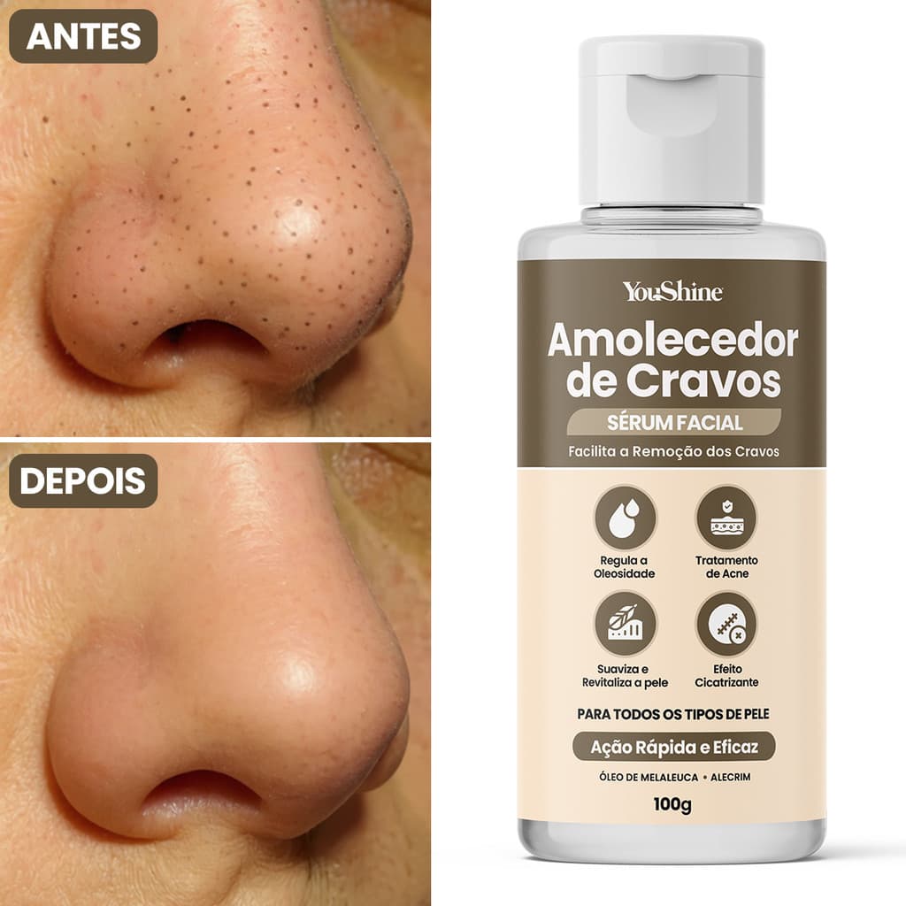 Sérum Amolecedor de Cravos YouShine 100g Remoção Fácil Cicatrizante Antisséptico
