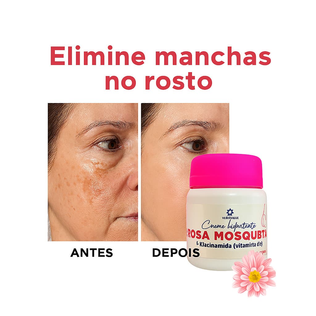 Creme Clareador Rosa Mosqueta com Niacinamida | Manchas no Rosto Antirrugas Melasma