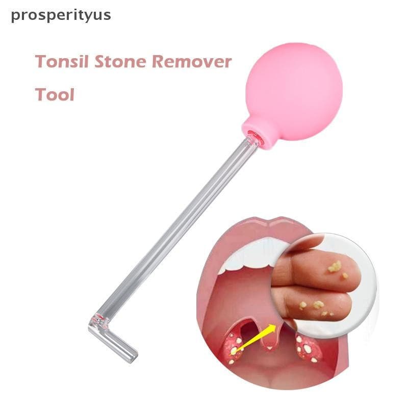 [prosperityus] Ferramenta Removedora De Pedra De Amígdala Removedor De Estilo Manual De Cuidados Para Limpeza De Boca De