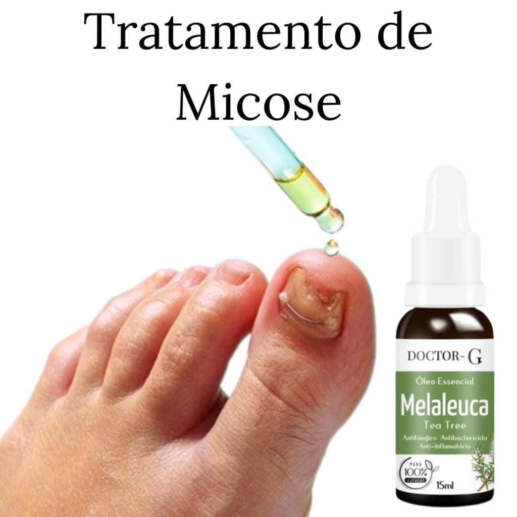 Oleo Essencial Melaleuca 100% Puro Australiano Tea Tree 15ML- DOCTOR-G