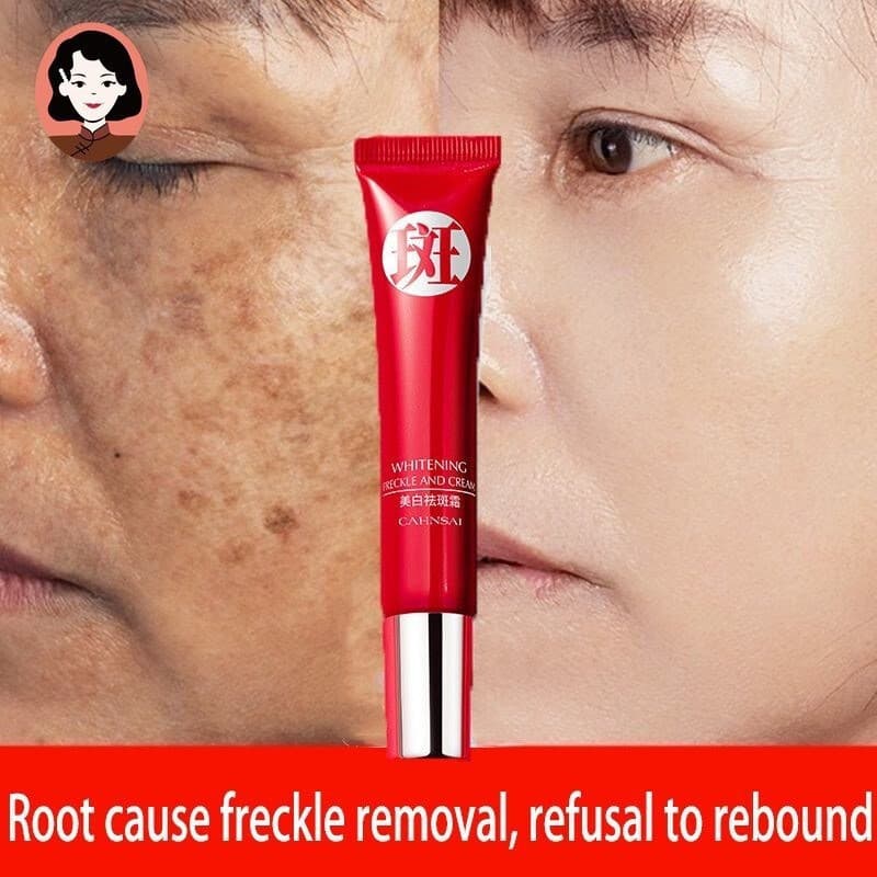 Creme original forte para remoção de manchas escuras/pigmentação clarificada/cuidados com a pele