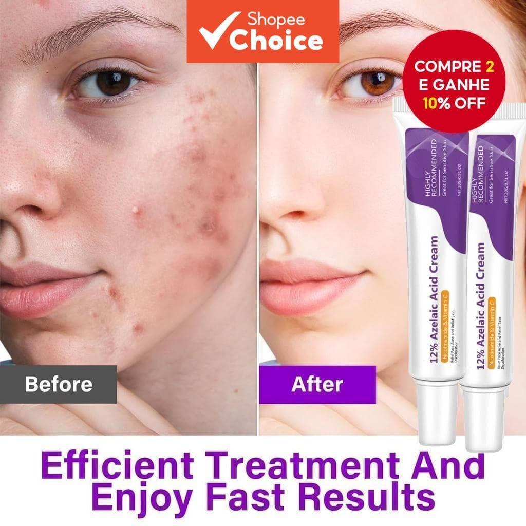 Ácido Azelaico 12 % Creme Facial 20g Niacinamida Vitamina C Iluminador Calmante Cuidados Com A Pele