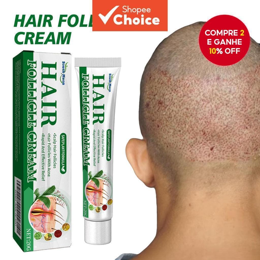  【HOT】 South Moon Hair Follicle Cream Creme de Limpeza do Couro Cabeludo Removedor de Acne Nutritivo Reparação da Pele