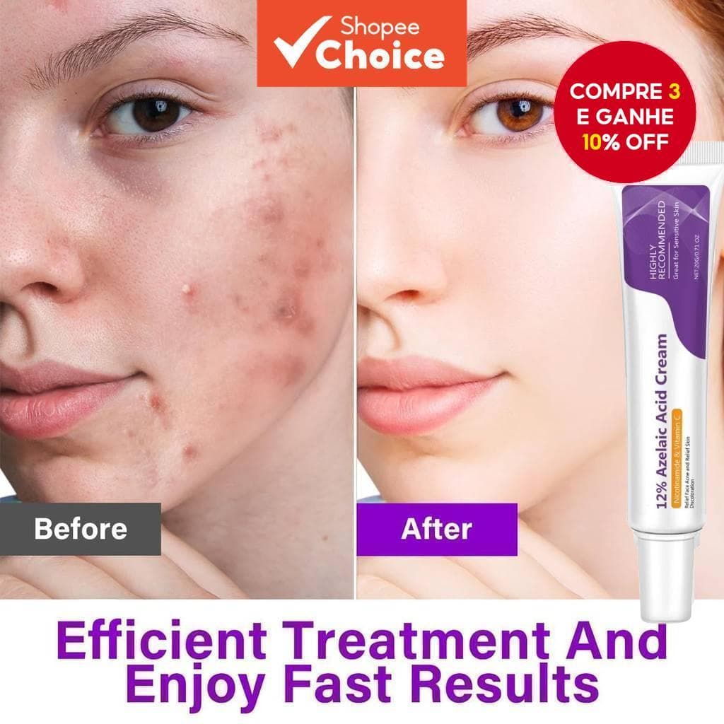 Creme De Ácido Azelaico Niacinamida 20g 12 % Vitamina C Iluminador Calmante Cuidados Com A Pele Facial