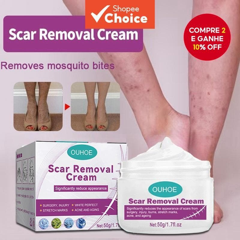 Creme De Remoção De Cicatriz Pé Reparação Cicatrizes Antigas