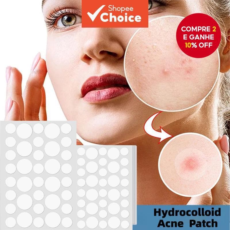 36PCS Adesivos para Acne, Patches Hidrocolóides para Espinhas e Imperfeições, Kit para Pele Limpa.