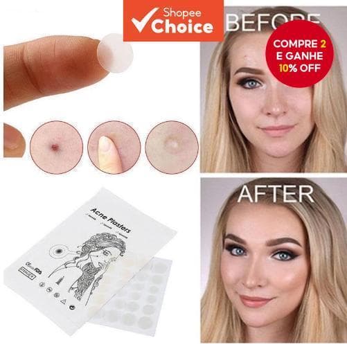 36 Pasta Grânulos Acne Remendo Percolação Corretivo Líquido Colóide Anti