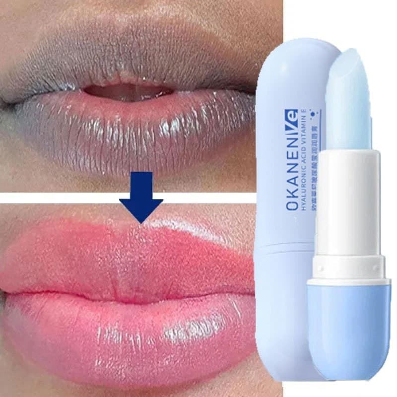 Bálsamo Labial Remover Pigmento Escuro Clareamento Creme Hidratante Ácido Hialurônico Esfoliante Pele Beleza Cuidados De