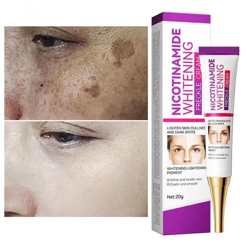 Creme De Melasma Clareador De Niacinamida Suave , Melanina , Remove Pigmento Escuro , Hidratante , Cuidados Com A Pele