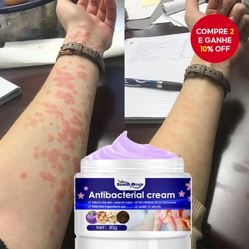 Pomada Antibacteriana para Coceira e Doenças de Pele como Alergia, Dermatite, Psoríase, Eczema, Antifúngica