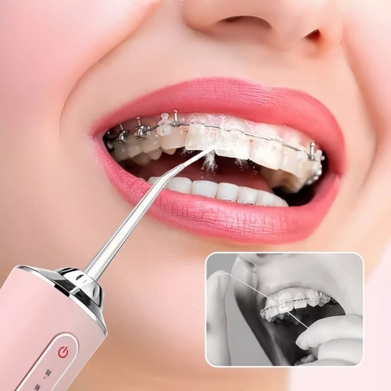 Irrigador de Jato Bocal F7 Recarregável – 220ml Portátil para Higiene Oral e Cuidado de Dentes e Gengiva