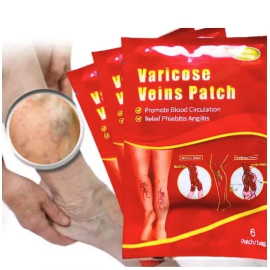 Kit 6 Adesivos Para Varizes Vasos Veias Vasculite Diminuição Inchaço Natural