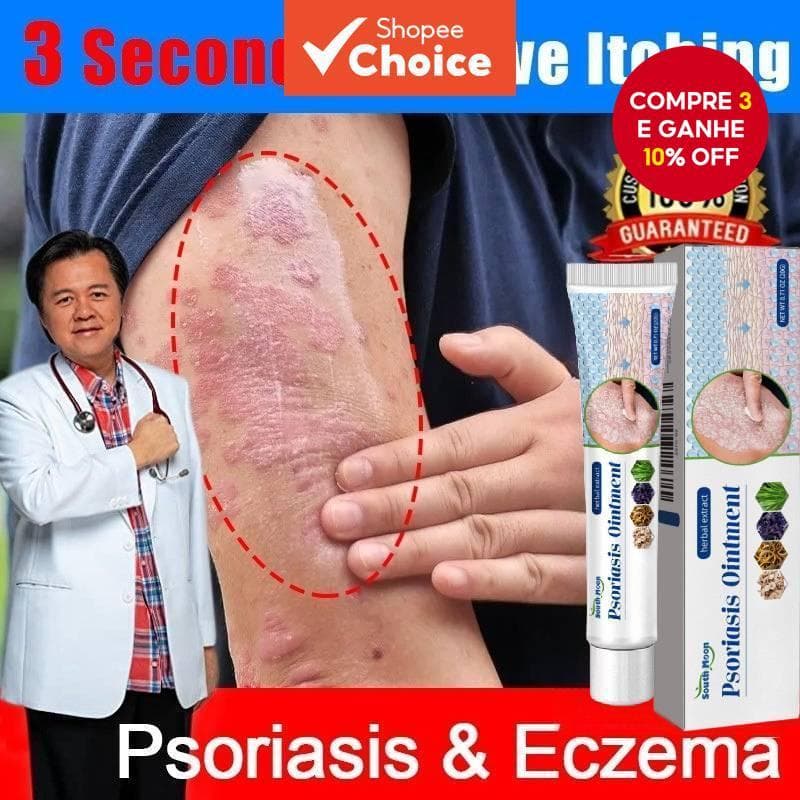  Creme Antibacteriano para Psoríase da Lua Sul - Ervas Eficazes para Alívio de Coceira - Tratamento Dermatite, Eczema,