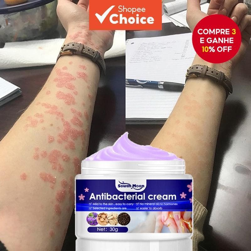  Pomada Antibacteriana para Coceira e Doenças de Pele como Alergia, Dermatite, Psoríase, Eczema, Antifúngica