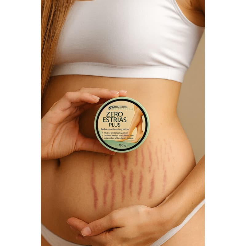 Creme Zero Estrias Plus Removedor Anti Estrias Trata E Previne 150g - RedFour original