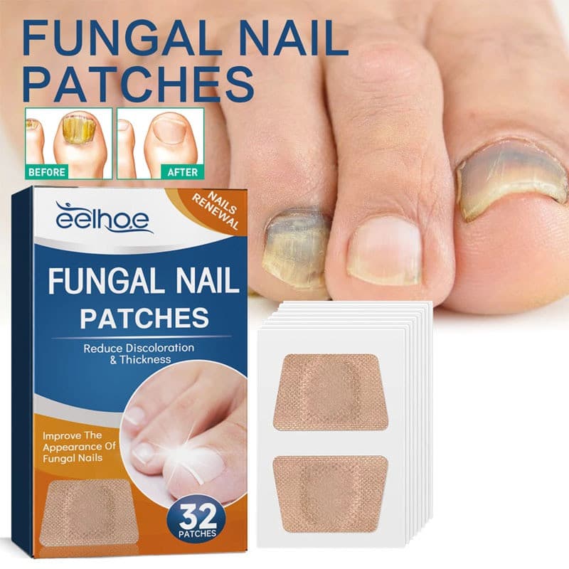 32/64 Peças Adesivo Reparador de Unhas - melhorar Fungo, Unhas Espessas e Paroníquia (Mãos e Pés)