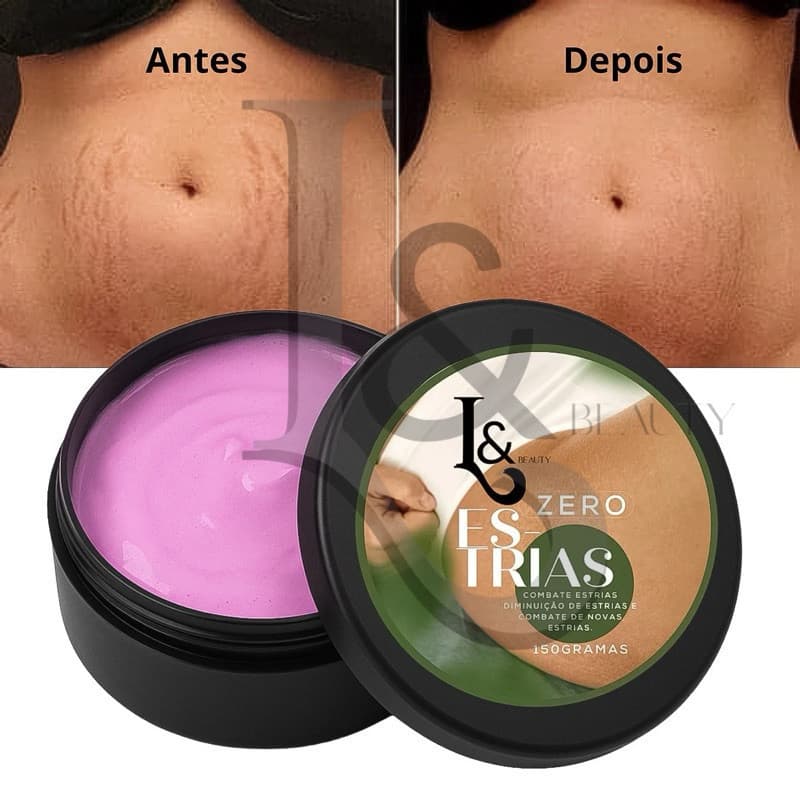 Creme Redutor De Estrias Trata E Previne 150g - L&Beauty