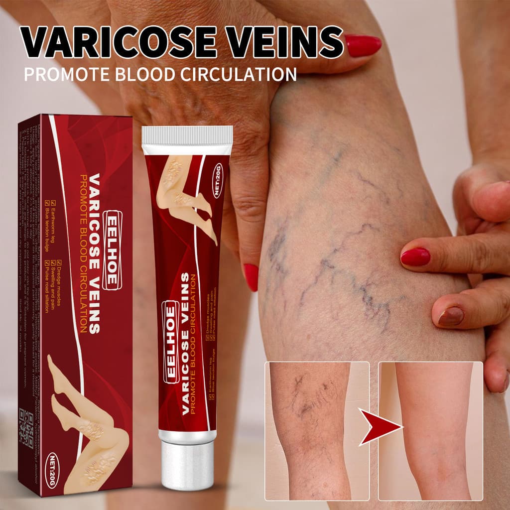 20g De Creme Para Veias Varicosas Com Gerânio , Lentilha E Erva-Mãe | Previne A Recuperação , Fórmula Não Gordurosa De A