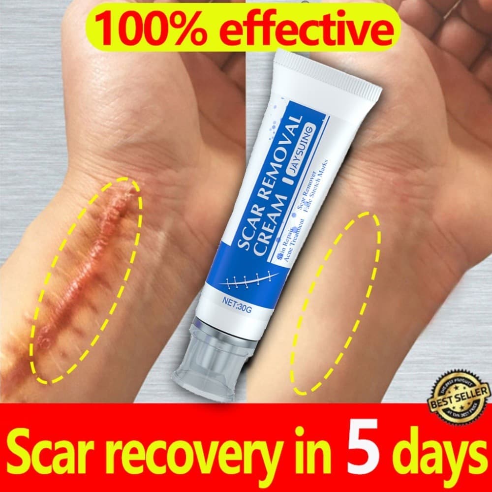 Advanced Scar 30g Creme Reparador Com Centella , Manteiga De Karité E Esqualano-Seguro Para Gravidez Adequado Crianças ,