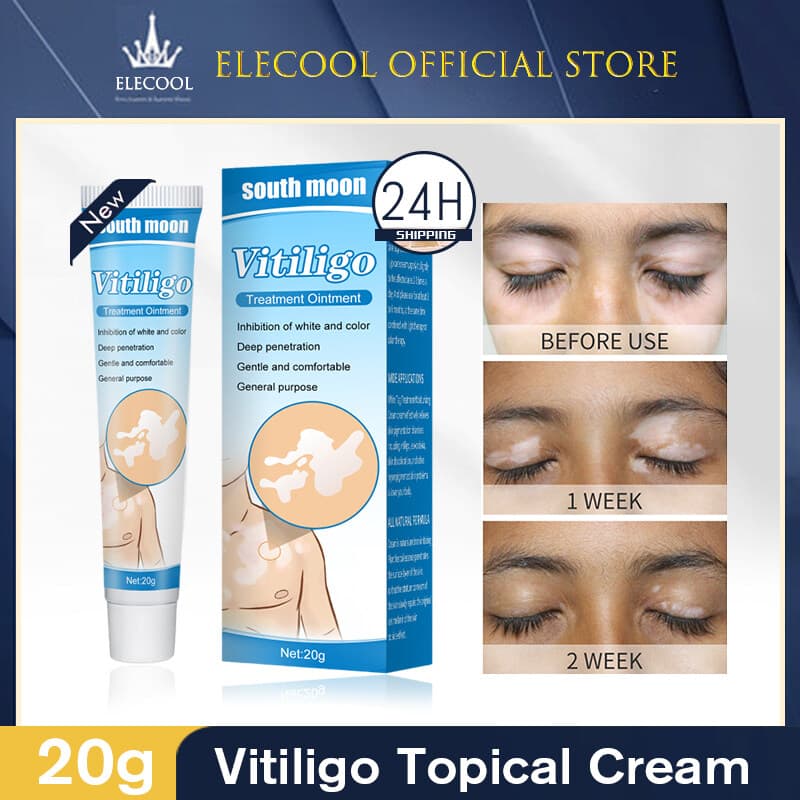 Pomada para tratamento de vitiligo Lua do Sul 20g - Pomada tópica